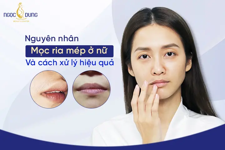 Cách Tẩy Ria Mép Ở Con Gái