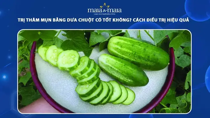Cách Trị Gàu Bằng Dưa Leo