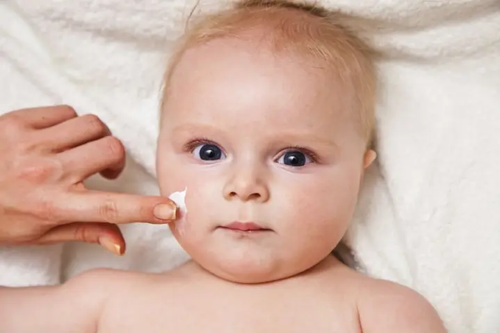 Cách Trị Lang Beng Cho Tre So Sinh Cách Trị Lang Beng Cho Tre So Sinh