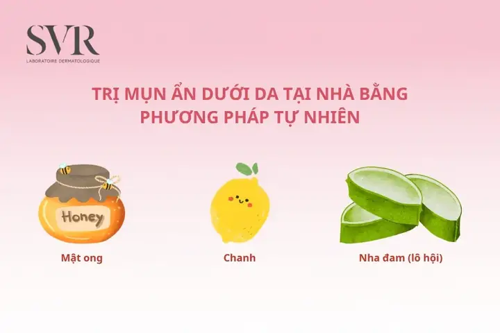 Cách Trị Mụn An Dưới Da Bằng Thiên Nhiên