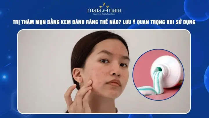 Cách Trị Mụn Bằng Muối Và Kem Đánh Răng