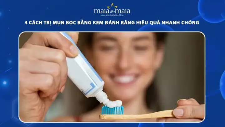 Cách Trị Mụn Bằng Muối Và Kem Đánh Răng