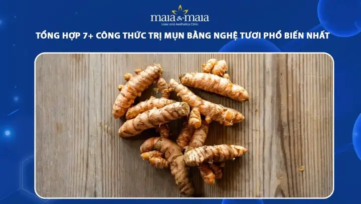 Cách Trị Mụn Bằng Nghệ Tươi Và Mật Ong