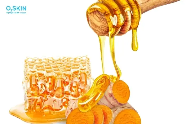 Cách Trị Mụn Bằng Nghệ Tươi Và Mật Ong