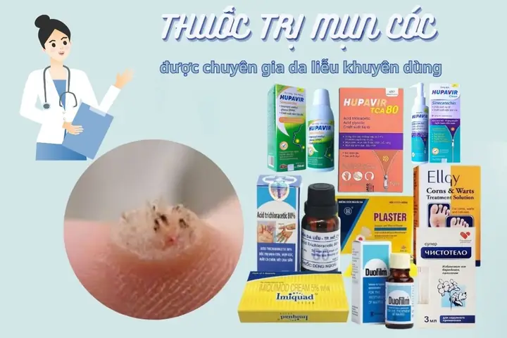 Cách Trị Mụn Bằng Thuốc Bắc