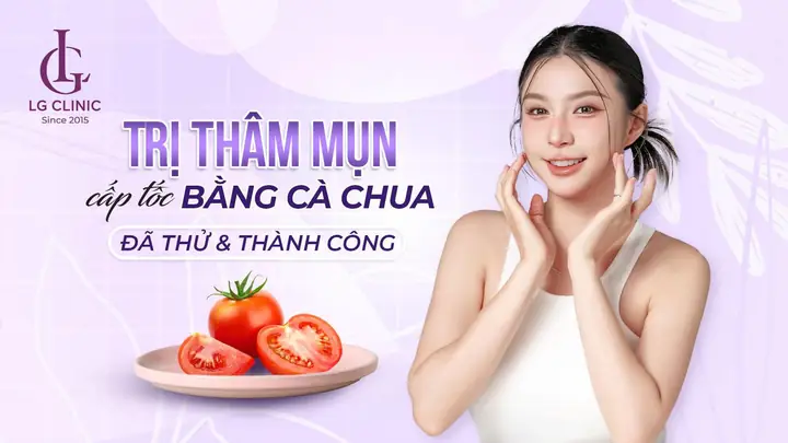 Cách Trị Mụn Tại Nhà Bằng Cà Chua