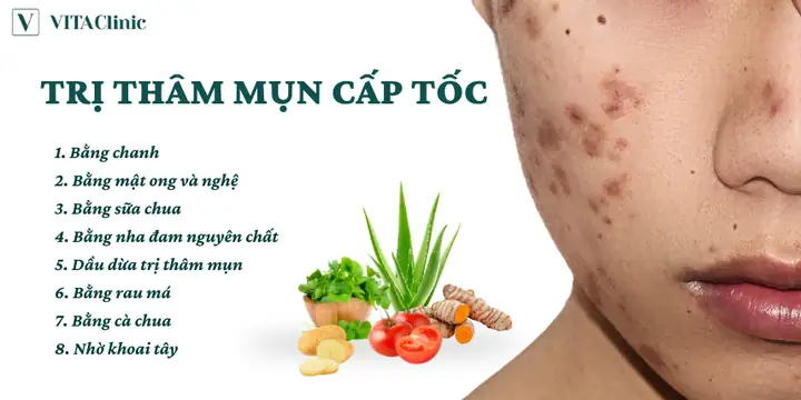 Cách Trị Mụn Thâm Trên Mặt