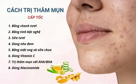 Cách Trị Mụn Thâm Trên Mặt