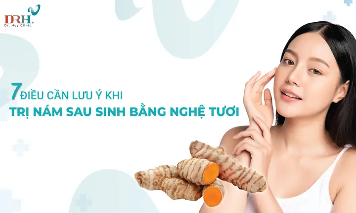 Cách Trị Nám Sau Sinh Bằng Nghệ Tươi