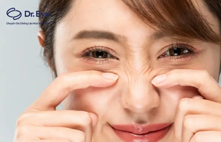 Cách Trị Nếp Nhăn Dưới Bọng Mắt