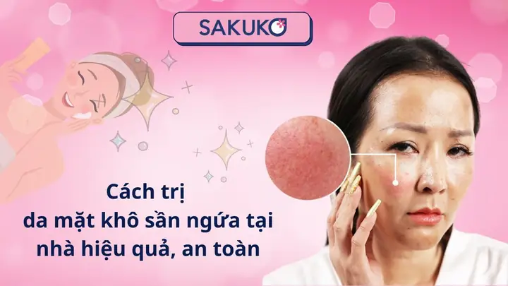 Cách Trị Nhờn Da Mặt Tại Nhà