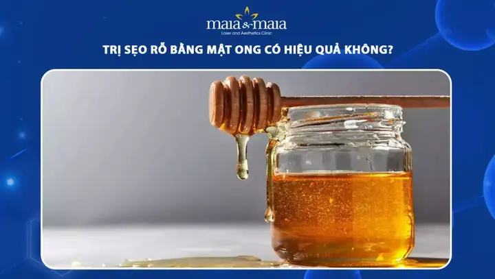 Cách Trị Rỗ Mặt Bằng Mật Ong
