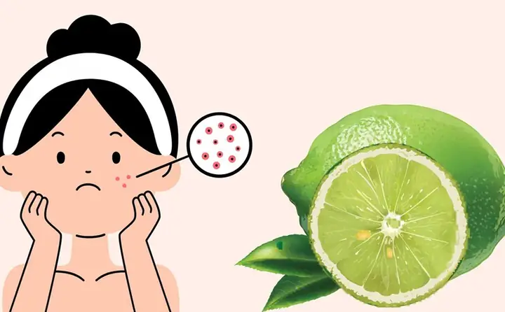 Cách Trị Tàn Nhang Bằng Rượu Nghệ