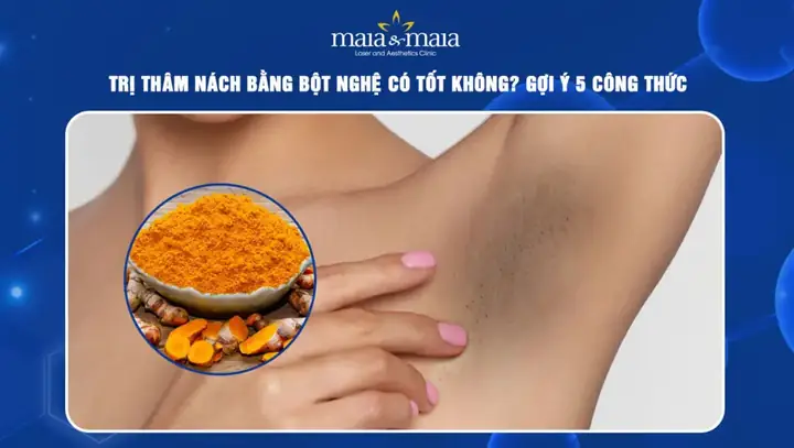 Cách Trị Thâm Bằng Bột Nghệ