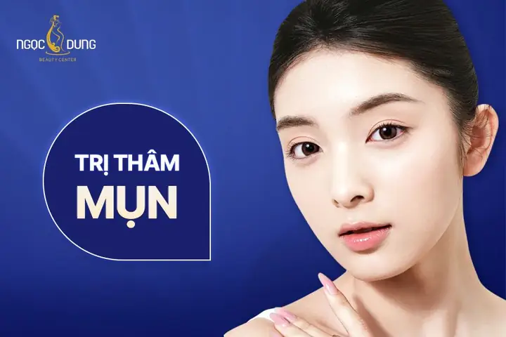 Cách Trị Thâm Chân Bằng Bột Nghệ
