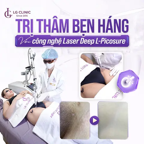 Cách Trị Thâm Háng Cho Nữ Tại Nhà