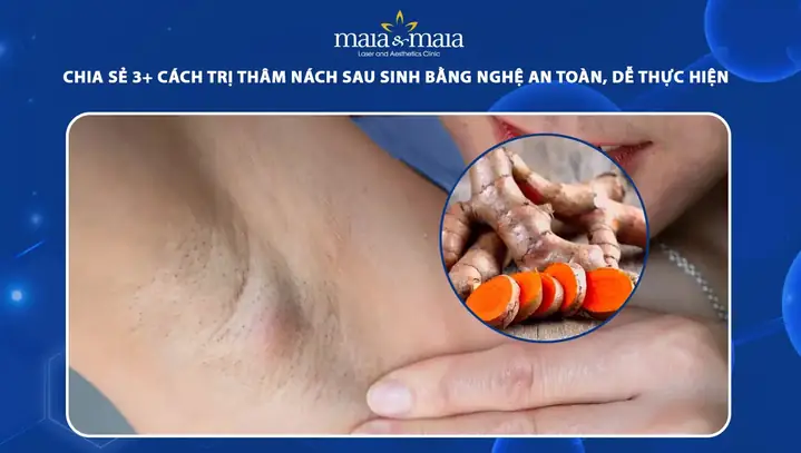 Cách Trị Thâm Nách Bằng Nghệ