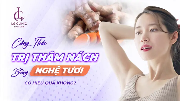 Cách Trị Thâm Nách Bằng Nghệ