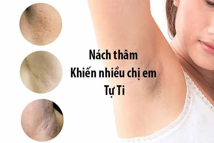 Cach Tri Tham Nach Tai Nha