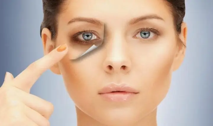 Cách Trị Thâm Quầng Mắt Bằng Mật Ong