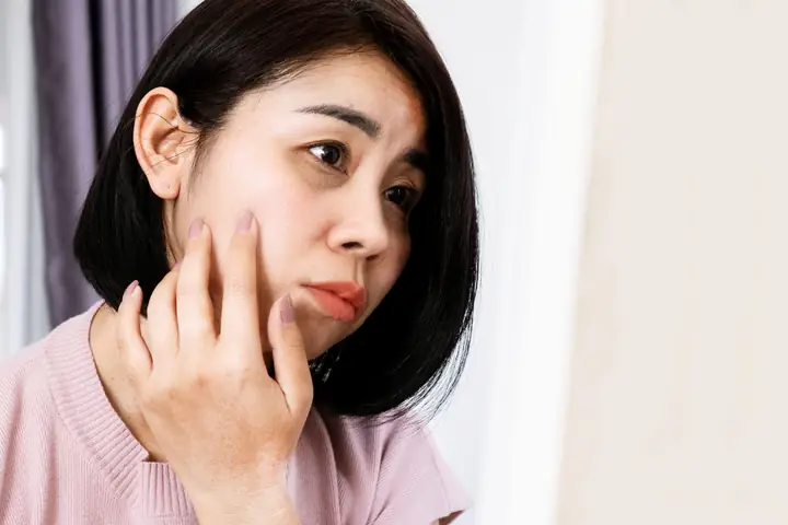 Cách Trị Thâm Quầng Mắt Bằng Mật Ong