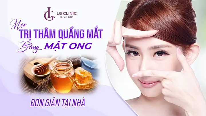 Cách Trị Thâm Quầng Mắt Bằng Mật Ong