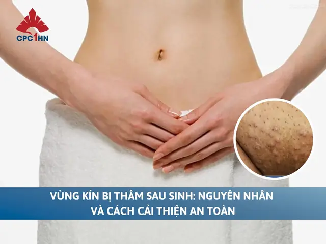 Cách Trị Thâm Sau Khi Sinh