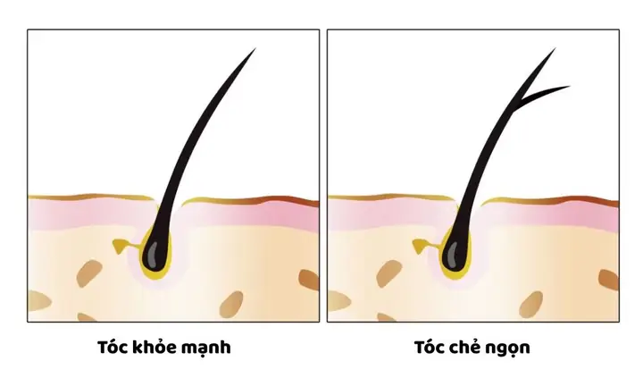 Cách Trị Tóc Bị Chẻ Ngọn