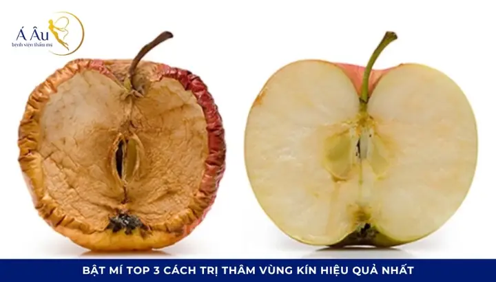 Cách Trị Vùng Kín Thâm Đen