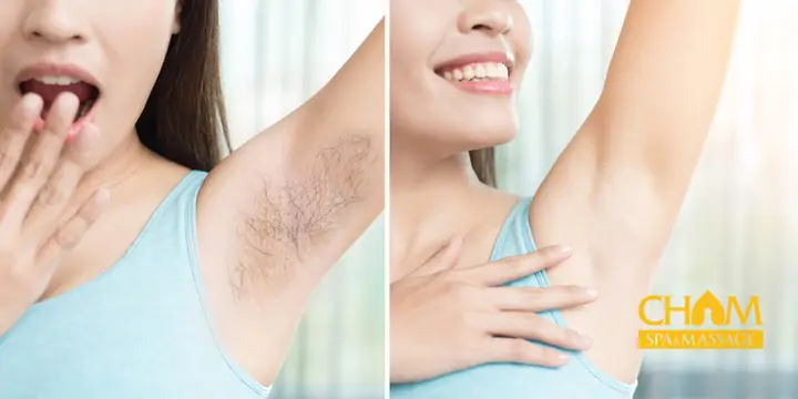 Cách Triệt Lông Nách Hiệu Quả