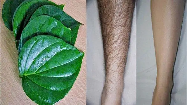 Cách Triệt Lông Tại Nhà Hiệu Quả