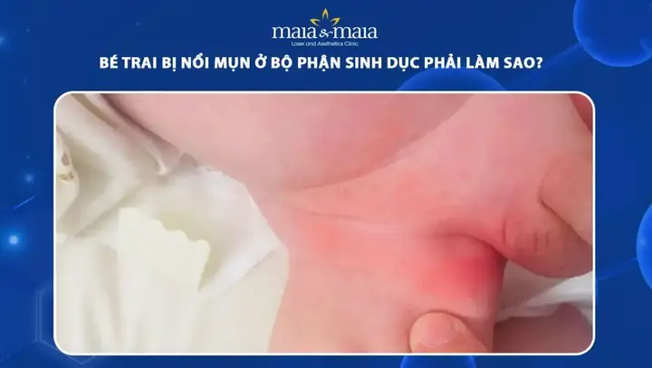 Cách Vệ Sinh Bộ Phận Sinh Dục Bé Trai