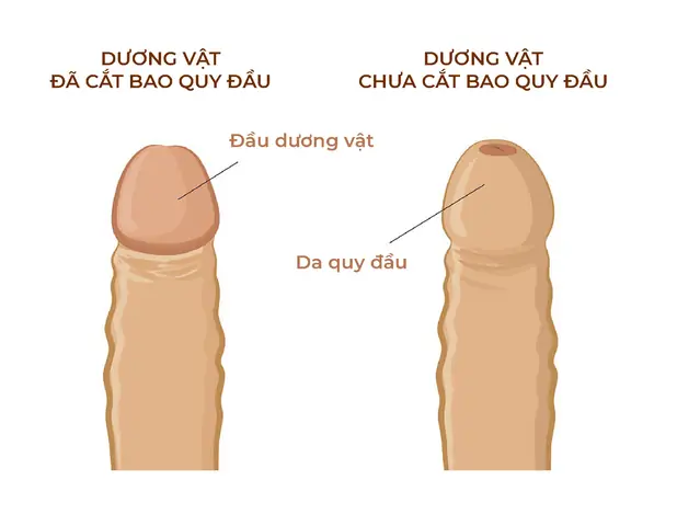Cách Vệ Sinh Bộ Phận Sinh Dục Bé Trai
