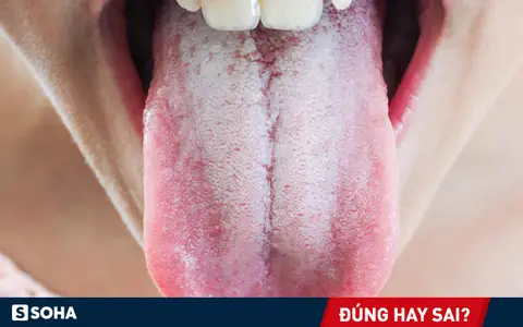 Cách Vệ Sinh Lưỡi Hàng Ngày