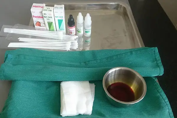 Cách Vệ Sinh Rốn Chưa Rụng Cách Vệ Sinh Rốn Chưa Rụng