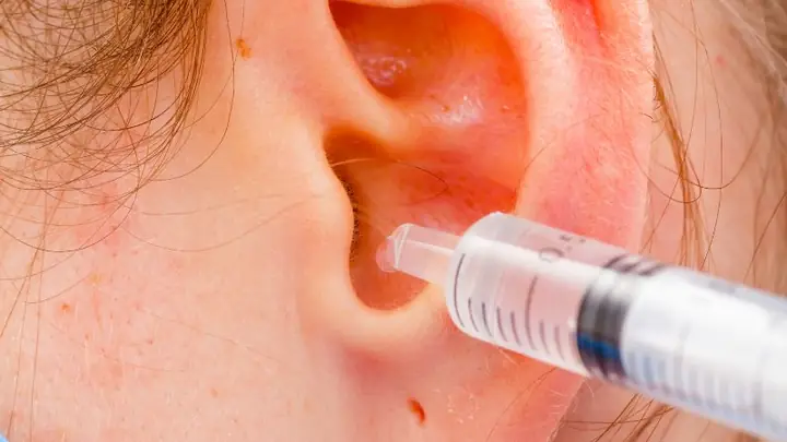 Cách Vệ Sinh Tai Bằng Nước Muối Sinh Lý