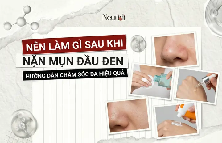 Cách Xông Mặt Không Bị To Lỗ Chân Lông