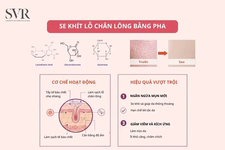 Cách Xông Mặt Không Bị To Lỗ Chân Lông
