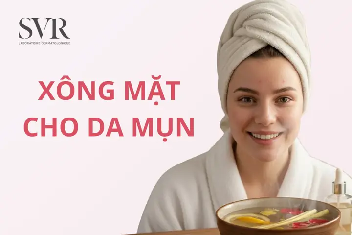 Cách Xông Mặt Trị Mụn Cho Da Nhờn Cách Xông Mặt Trị Mụn Cho Da Nhờn
