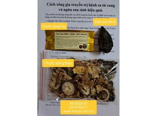 Cách Xông Thuốc Bắc Cho Bà Đẻ