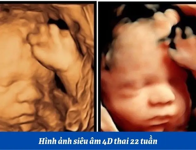 Cân Nặng Của Thai Nhi 22 Tuần Tuổi