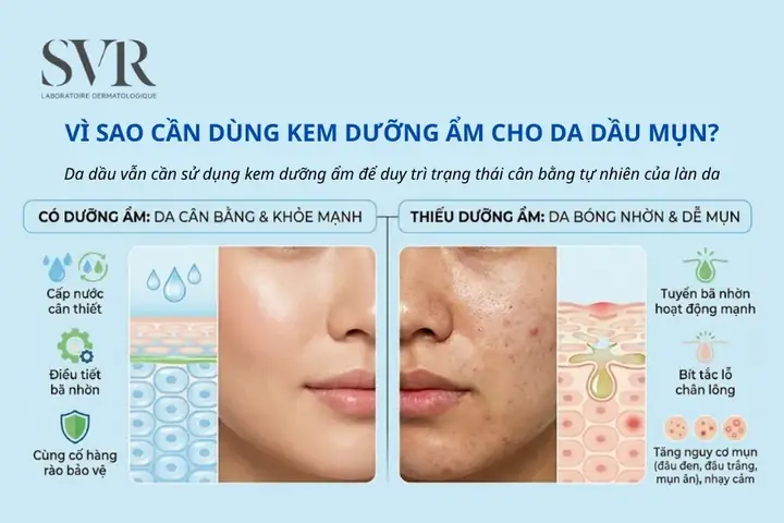 Cấp Ẩm Cho Da Dầu Mụn Tự Nhiên