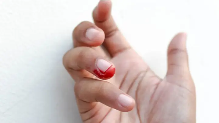 Cắt Móng Tay Cho Bé Bị Chảy Máu