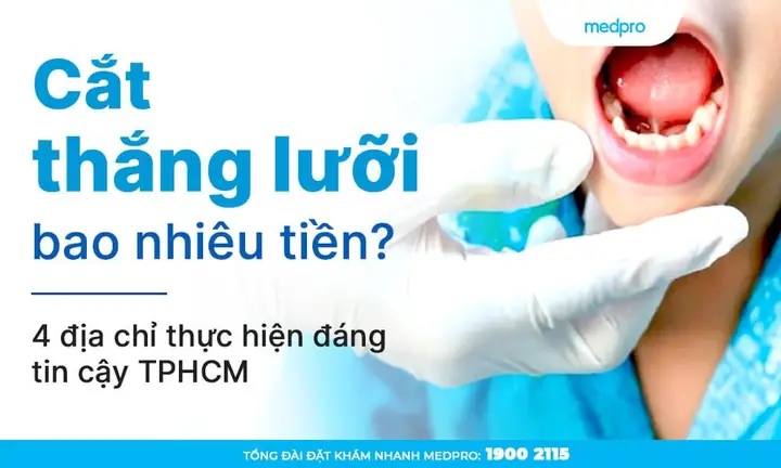 Cắt Thắng Lưỡi Cho Bé Bao Nhiêu Tiền