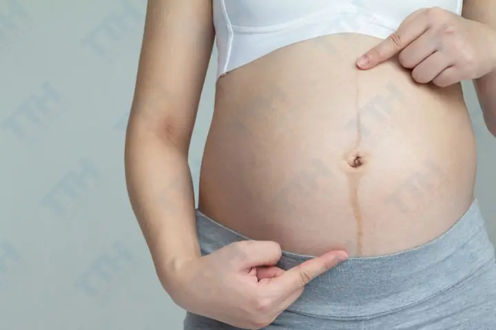 Chăm Sóc Da Cho Bà Bầu 3 Tháng Đầu