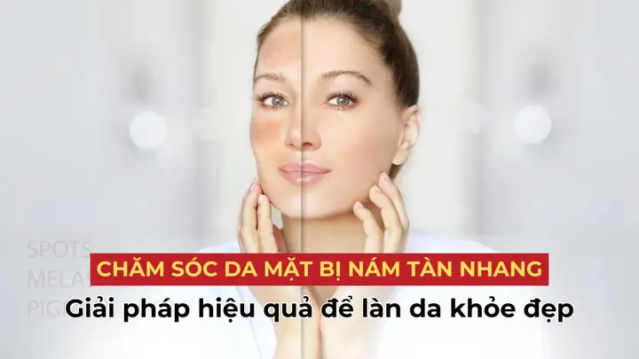 Chăm Sóc Da Mặt Bị Nám Tàn Nhang