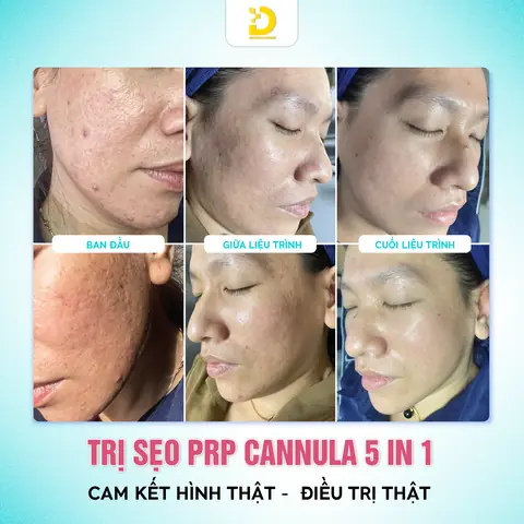 Chăm Sóc Da Ở Đâu Tốt Tphcm