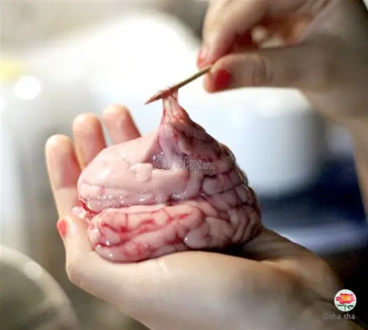 Cháo Óc Heo Đậu Hà Lan