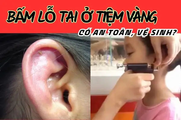 Chỗ Bấm Lỗ Tai An Toàn Ở Tphcm