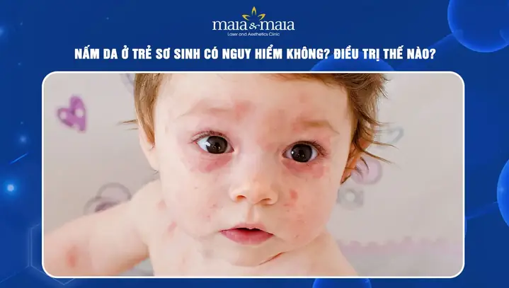 Chữa Nấm Da Ở Trẻ Sơ Sinh